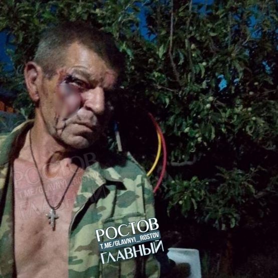 Пенсионера избили толпой в Ростовской области: сын просит защиты у Бастрыкина