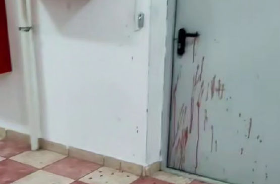 Ростовчанин устроил резню в многоэтажке Суворовского