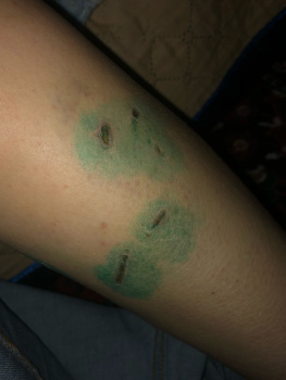 В Ростове на Западном женщину покусали бродячие собаки