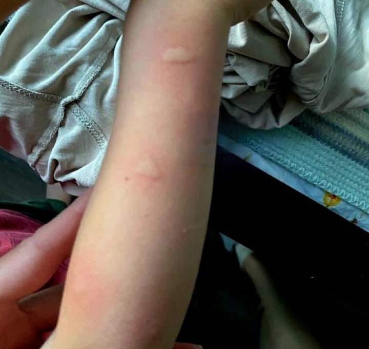 Жители Ростова жалуются, что власти перестали бороться с комарами